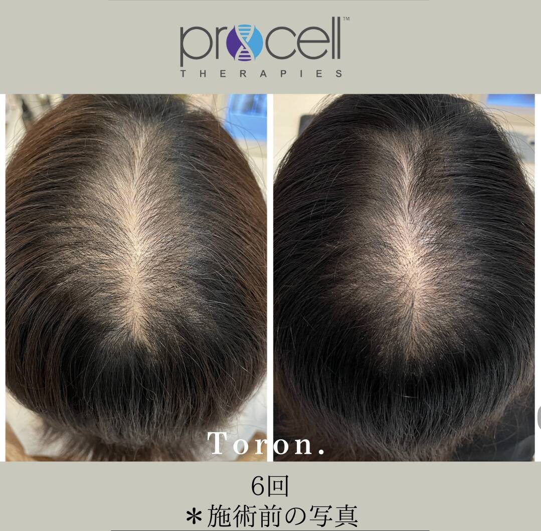 プロセルセラピーズ プロセルセラピーズ | Re'ante